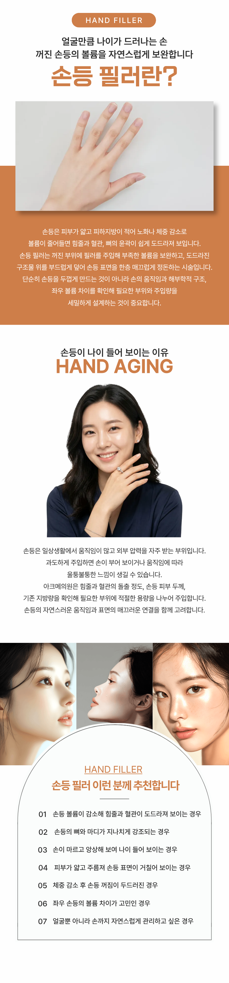 손등 필러 1