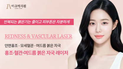 홍조 · 혈관 · 여드름 붉은자국 레이저