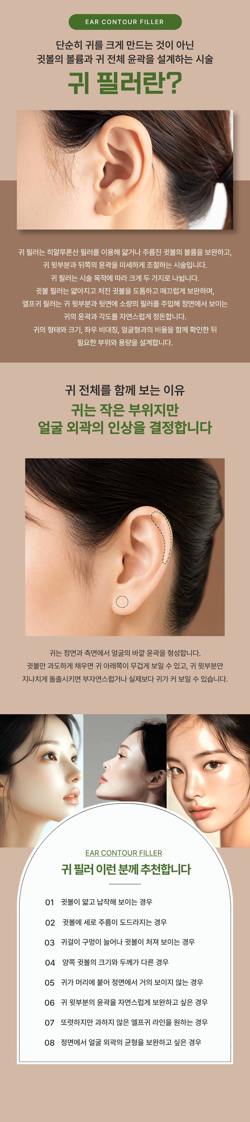 귀 필러(귓볼·엘프귀·요정귀) 1