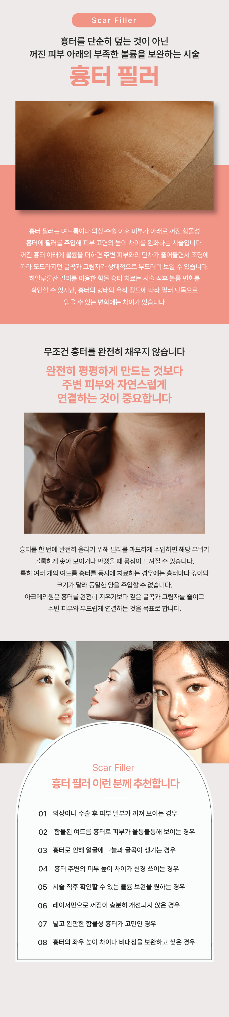 흉터 필러 1