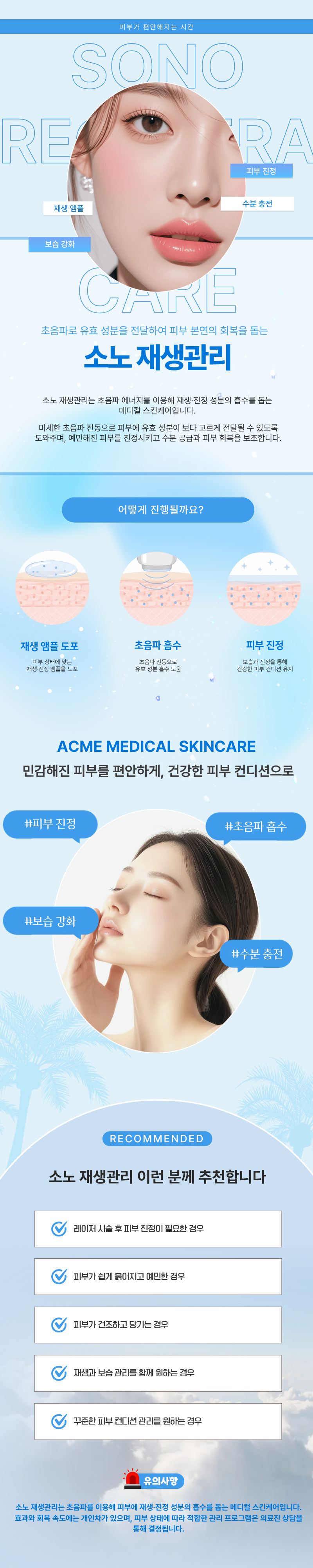 소노 재생관리 1
