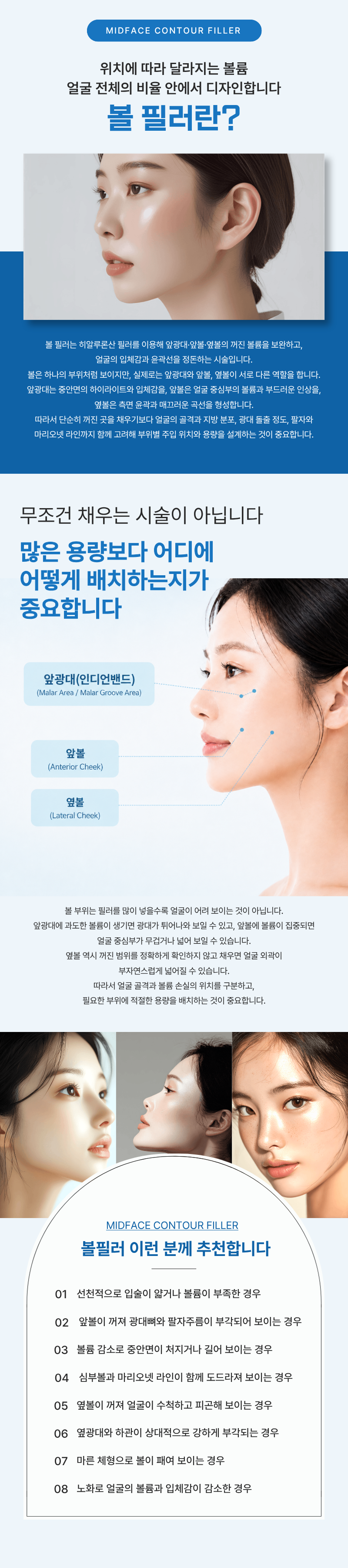 앞광대 (인디언밴드) 앞볼 · 옆볼 필러 1