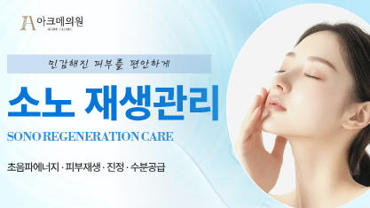 소노 재생관리