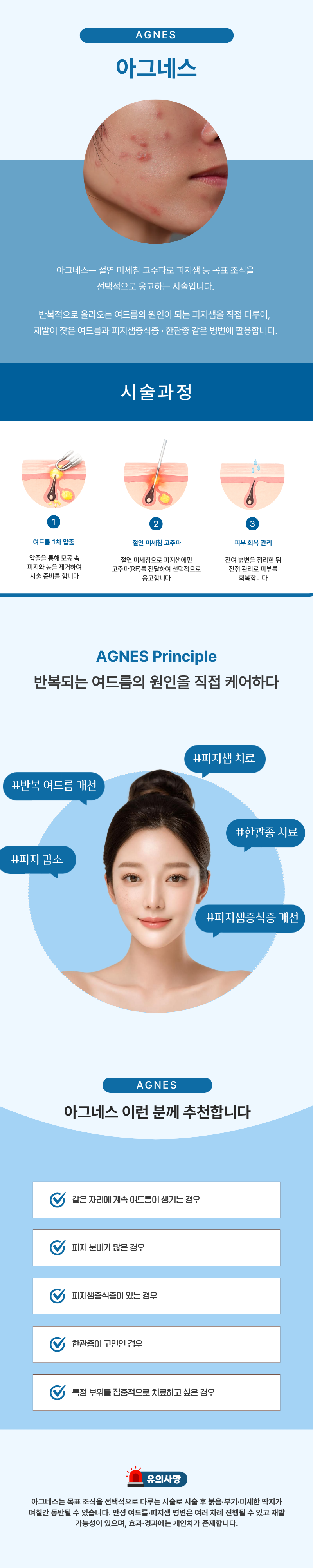 아그네스 1