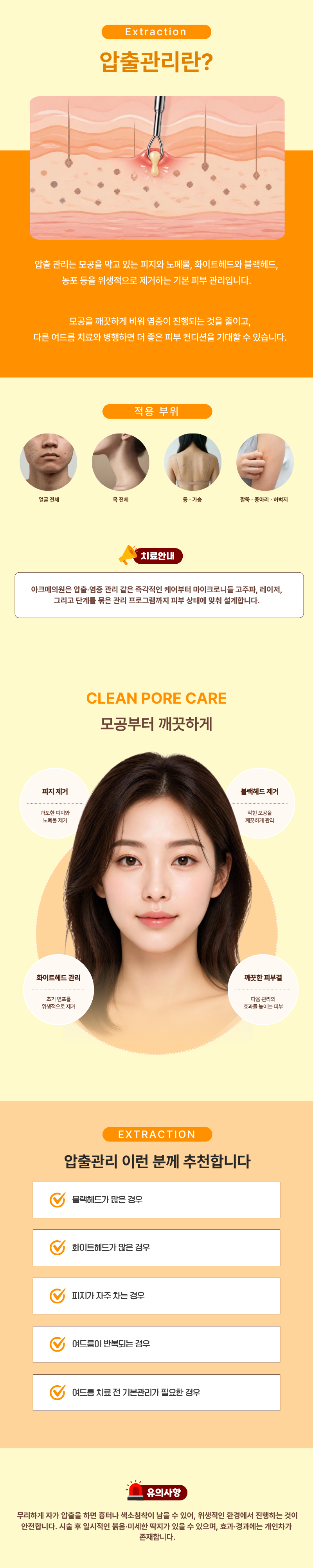 압출 관리 1