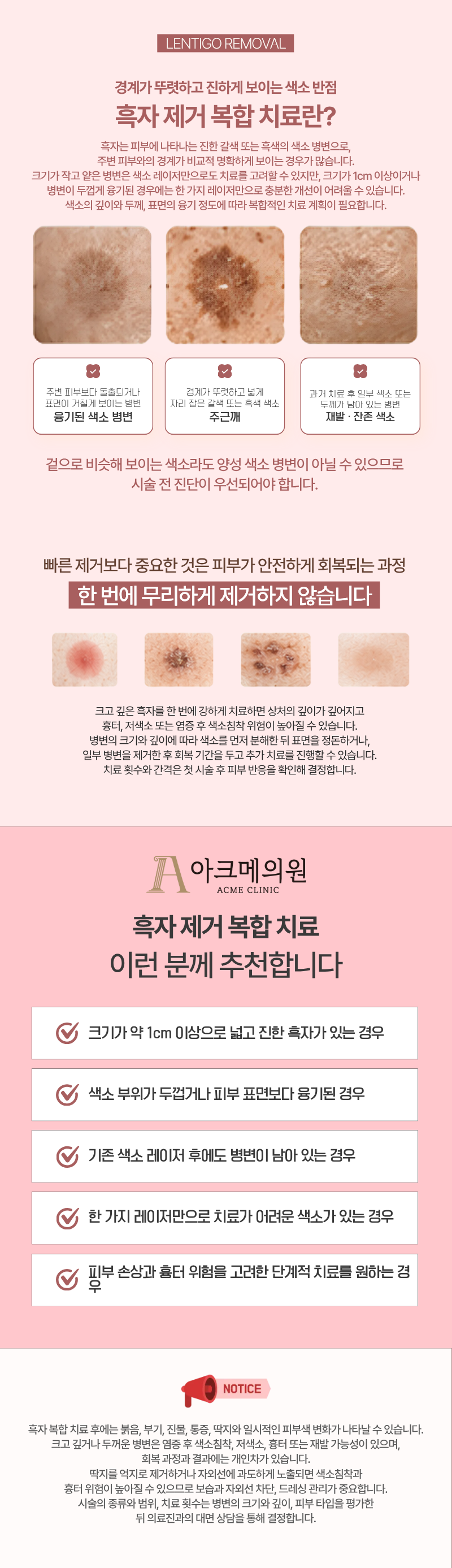 흑자 제거 (복합 치료) 1