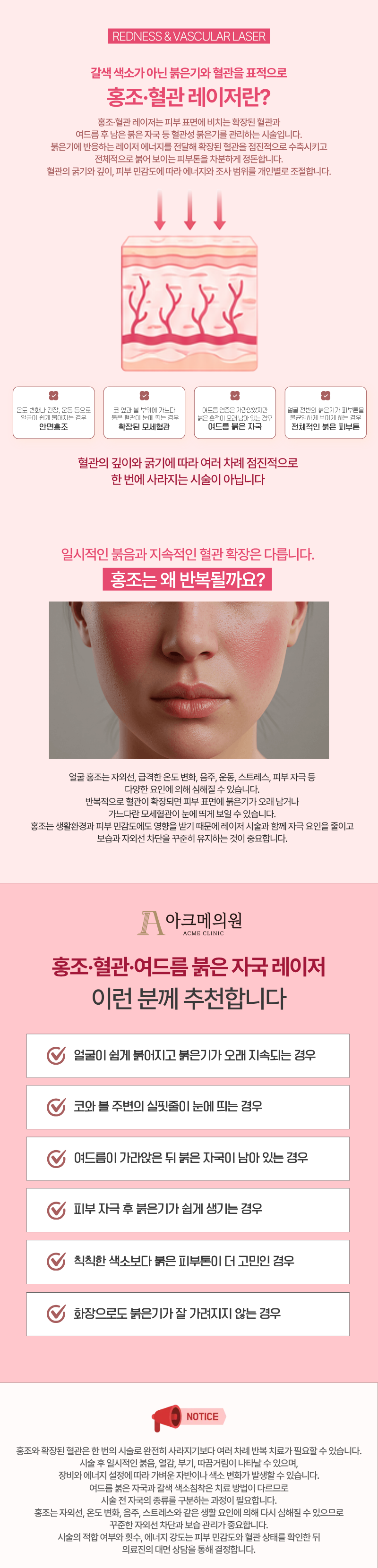 홍조 · 혈관 · 여드름 붉은자국 레이저 1