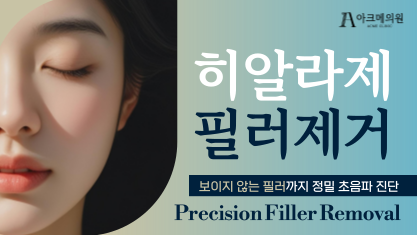 히알라제 필러제거