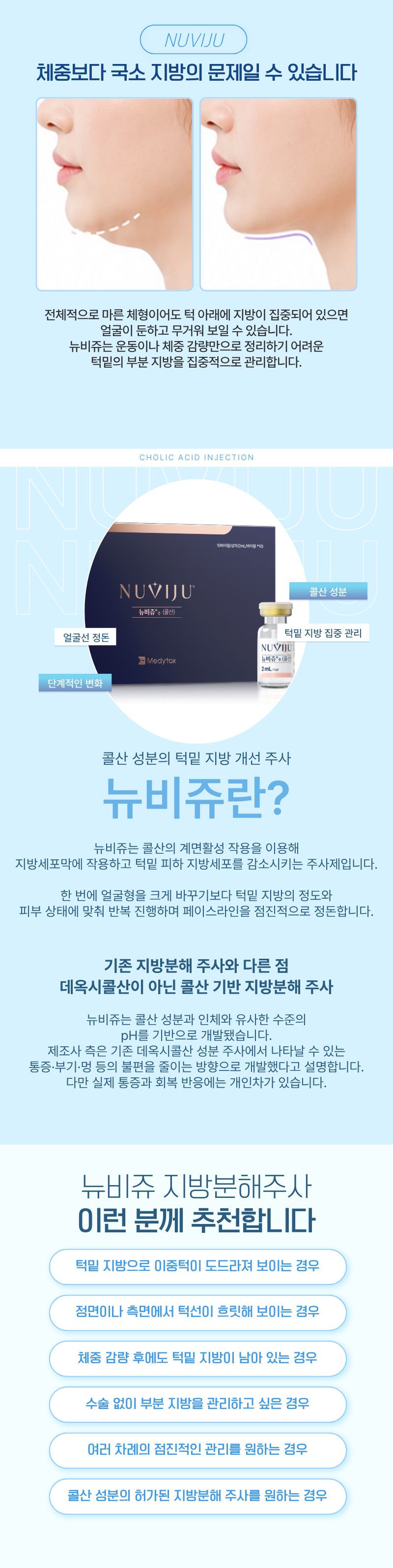 뉴비쥬 (콜린) 1
