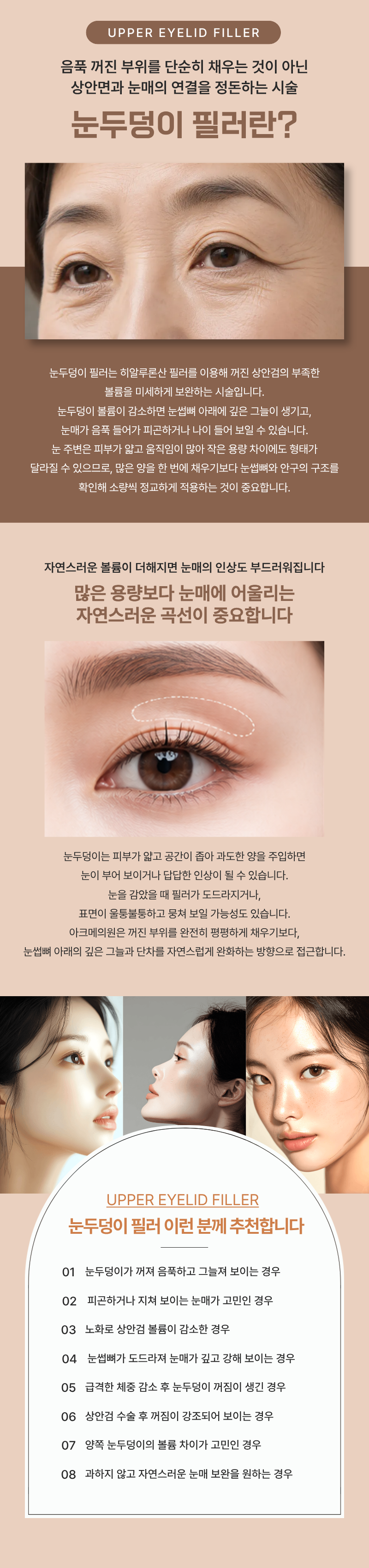 눈두덩이 필러 1
