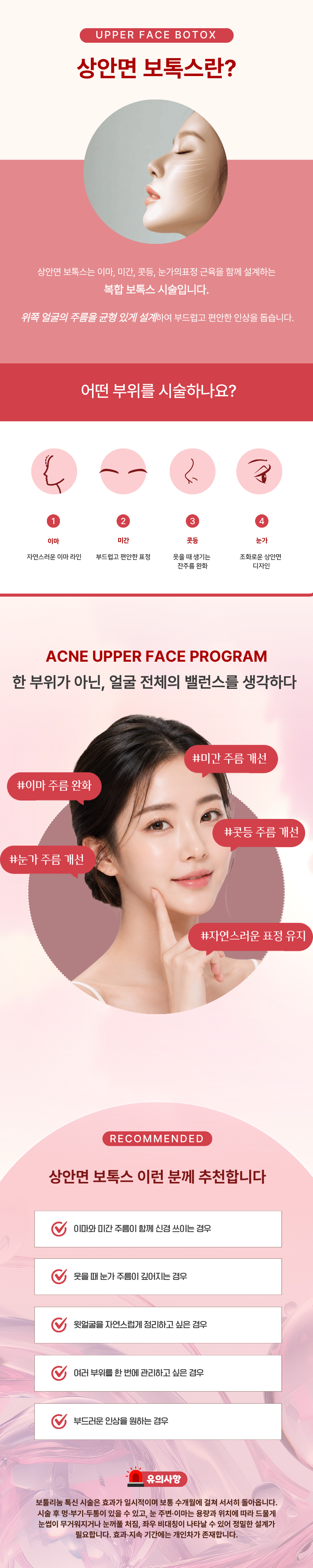 덜 아픈 상안면 보톡스(이마, 미간, 콧등, 눈가) 1
