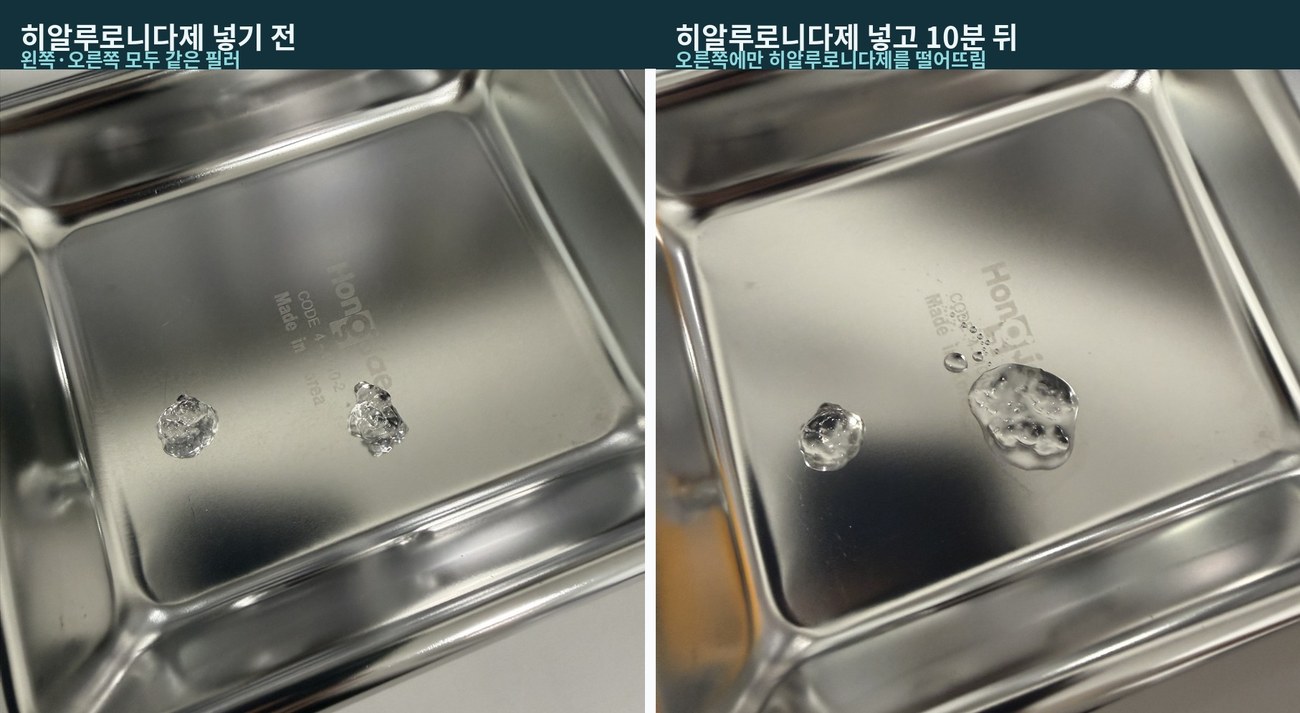40편-필러 녹이면 살이 빠지고 꺼질까? 실제로 줄어드는 건 필러 겔과 수분입니다