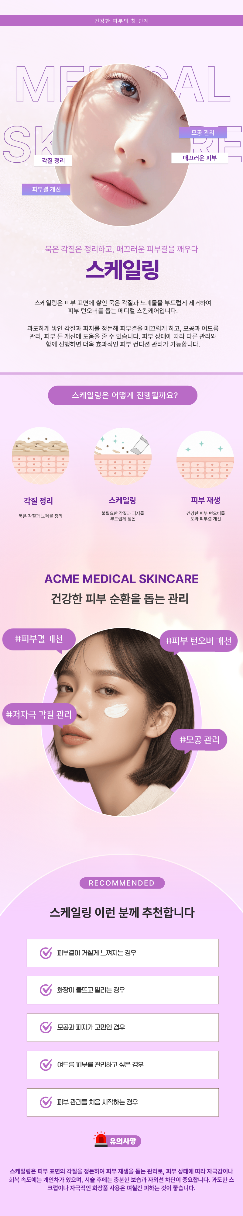 스케일링 1