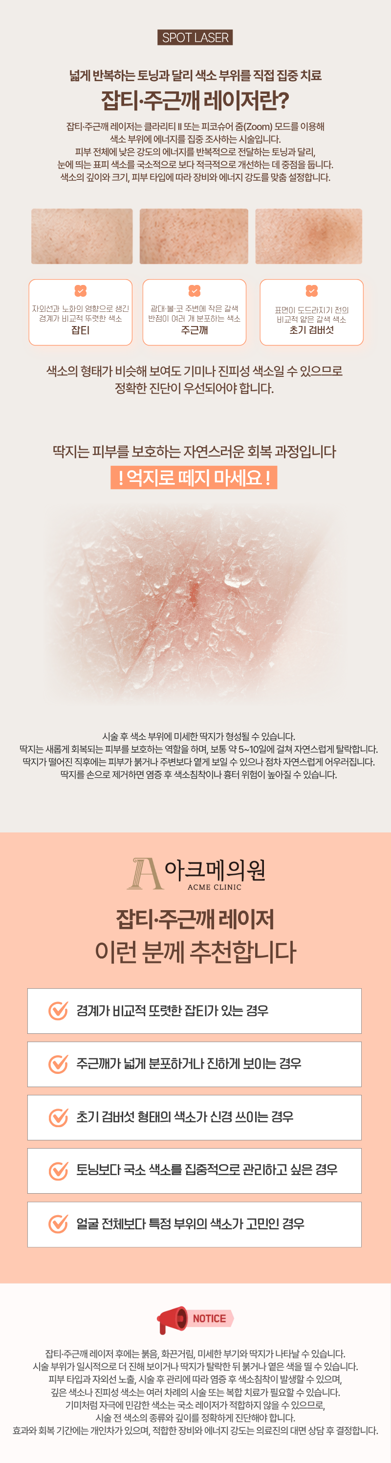 잡티·주근깨 레이저 1