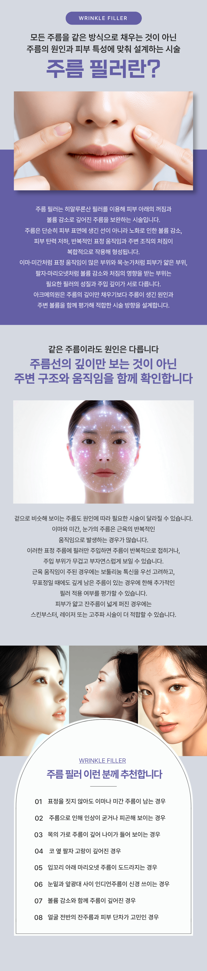 주름 필러 1