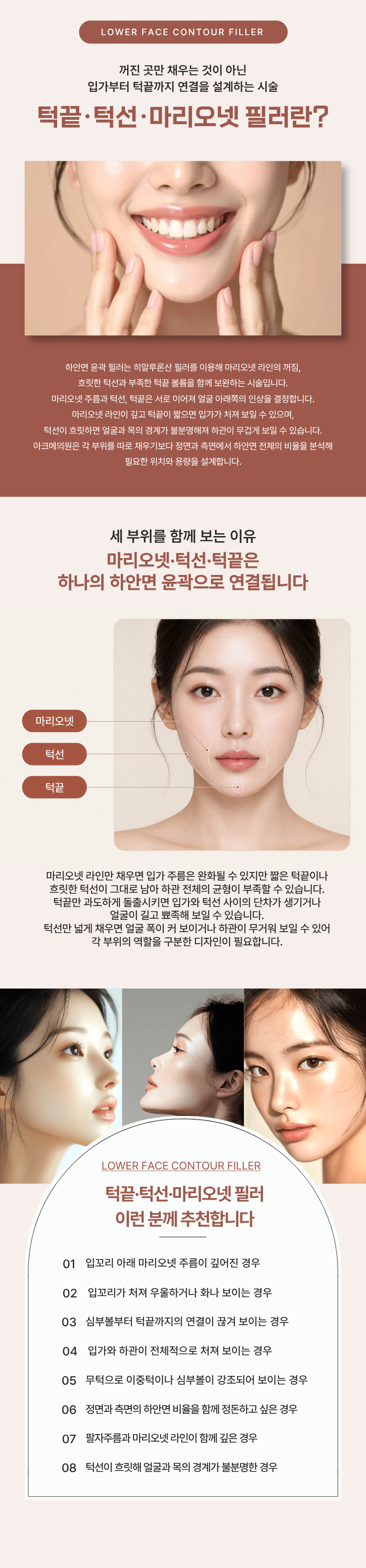 턱끝 · 턱선 · 마리오넷 필러 1