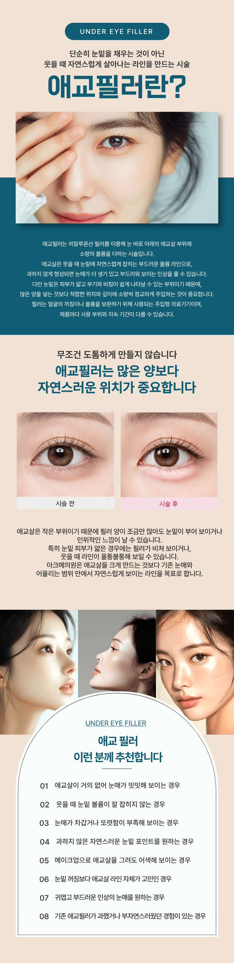 애교 필러 1