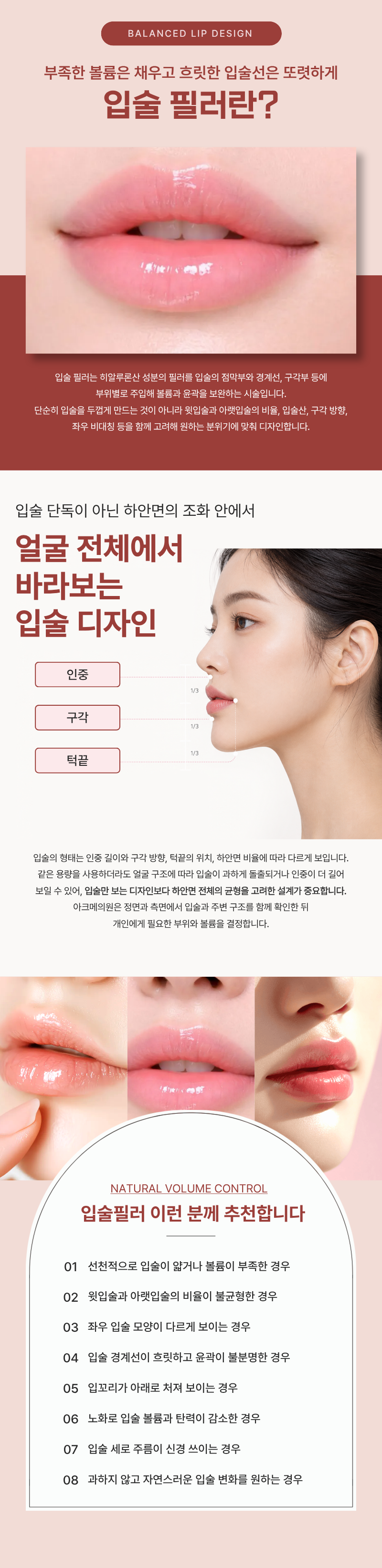 입술 필러 1