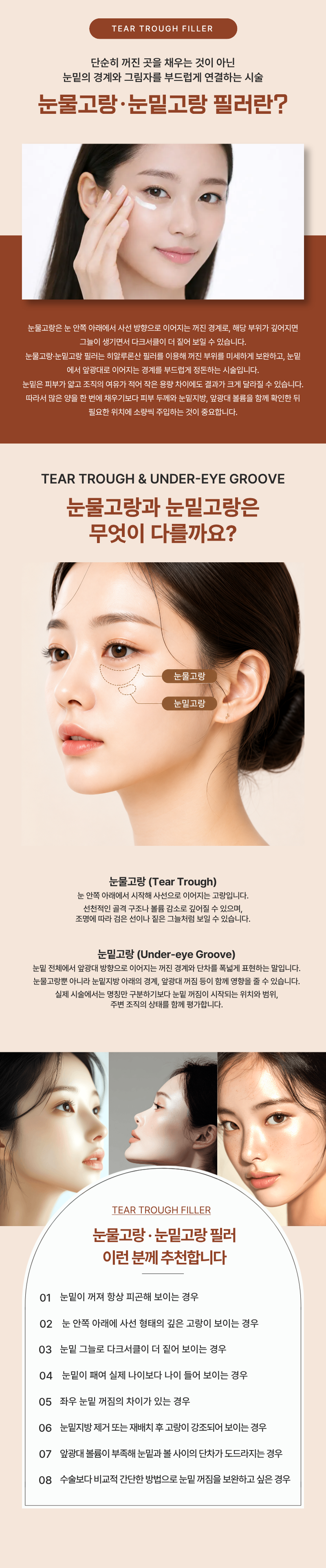 눈물고랑 · 눈밑고랑 필러 1