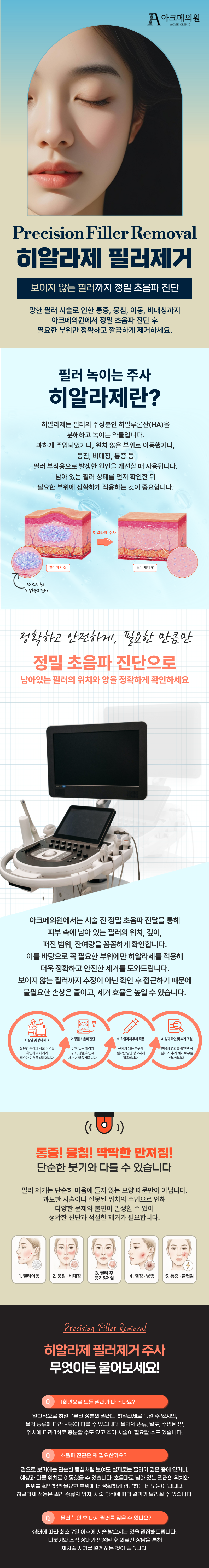 히알라제 필러제거 1