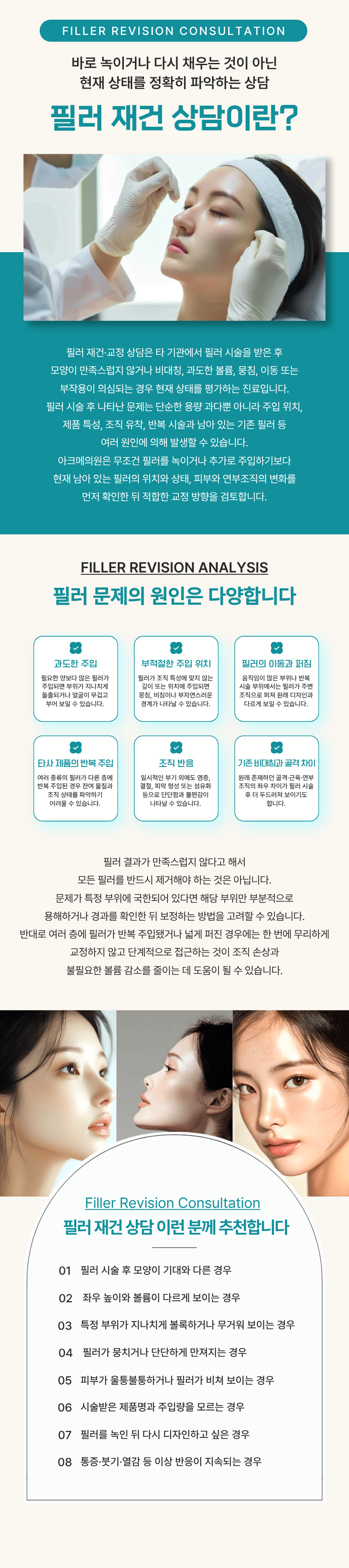 망한 필러재건 상담 1