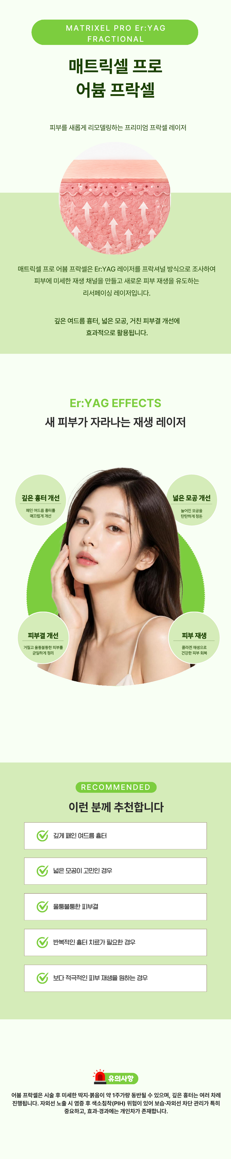 매트릭셀 프로 어븀 프락셀 1